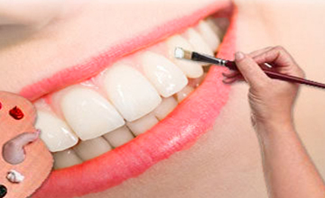 VernonSmiles Dental Cosmetic Dentistry service
